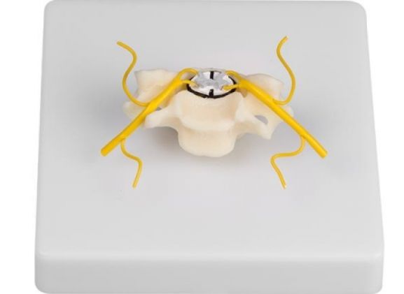https://jayakelana.jayakelana.id/uploads/product/-4067-vertebra-with-spinal-952539f2afe432b_cover.jpg