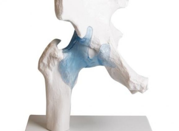 https://jayakelana.jayakelana.id/uploads/product/-4553-hip-joint-with-82763c414e2056d_cover.jpg