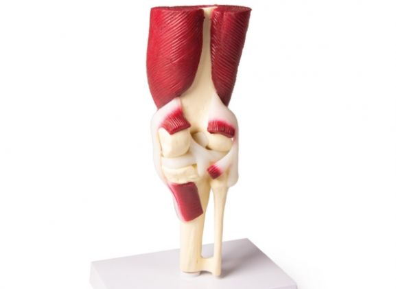 https://jayakelana.jayakelana.id/uploads/product/-4662-knee-joint-life-8299968e157feef_cover.jpg