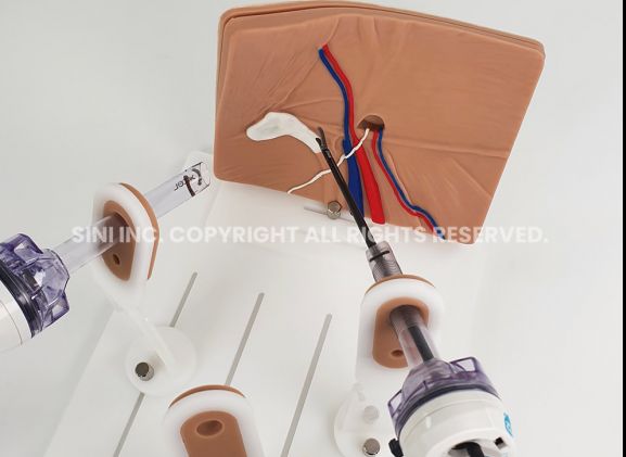 https://jayakelana.jayakelana.id/uploads/product/-a-lph-01-laparoscopic-hernia-surgery-7117416c2979294_cover.jpg