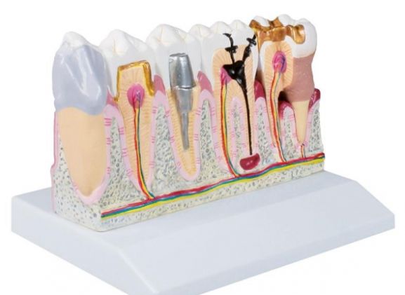 https://jayakelana.jayakelana.id/uploads/product/-d250-dental-model-4-74088418ba20bdb_cover.jpg