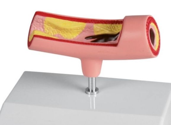 https://jayakelana.jayakelana.id/uploads/product/-g241-artery-model-772495449e734f5_cover.jpg