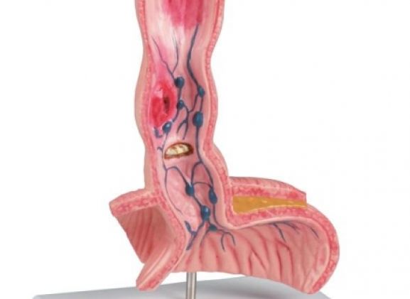 https://jayakelana.jayakelana.id/uploads/product/-k218-oesophagus-diseases-91822f04ad01eaf_cover.jpg