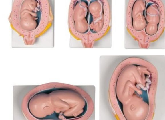 https://jayakelana.jayakelana.id/uploads/product/-l204-pregnancy-model-set--3240079c3983ebe_cover.jpg