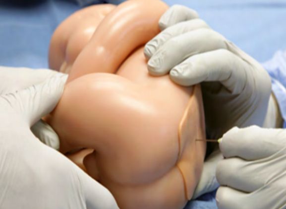 https://jayakelana.jayakelana.id/uploads/product/-lpb-40-lumbar-puncture-baby-752626142266041_cover.png
