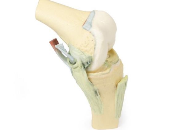 https://jayakelana.jayakelana.id/uploads/product/-mp1800-knee-joint-flexed-89418a7b40730c5_cover.jpg