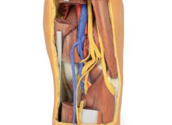 https://jayakelana.jayakelana.id/uploads/product/-mp1820-popliteal-fossa-distal-7454066ff46504e_cover.jpg