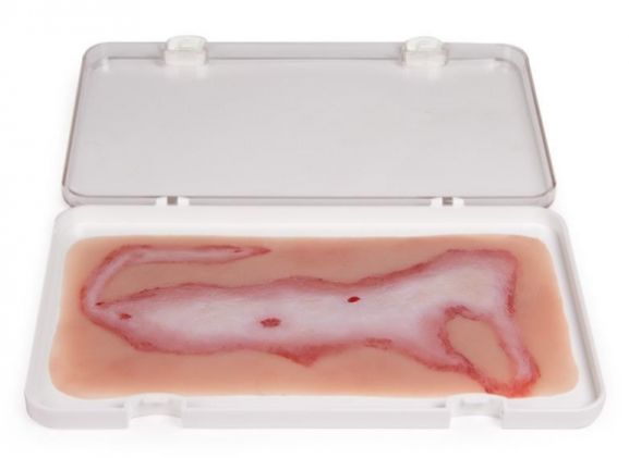 https://jayakelana.jayakelana.id/uploads/product/-nw108-wound-moulage-scalding-878556fa9e7b542_cover.jpg