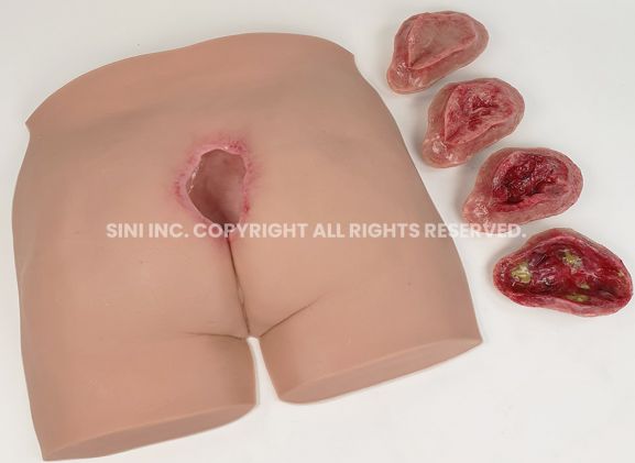 https://jayakelana.jayakelana.id/uploads/product/-p-deu-01-decubitus-ulcer-trainer-36706786ebaa4b7_cover.jpg