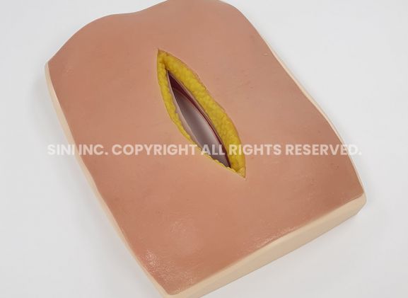 https://jayakelana.jayakelana.id/uploads/product/-s-afs-01-abdominal-fascia-suture-968431c7eb30eca_cover.jpg