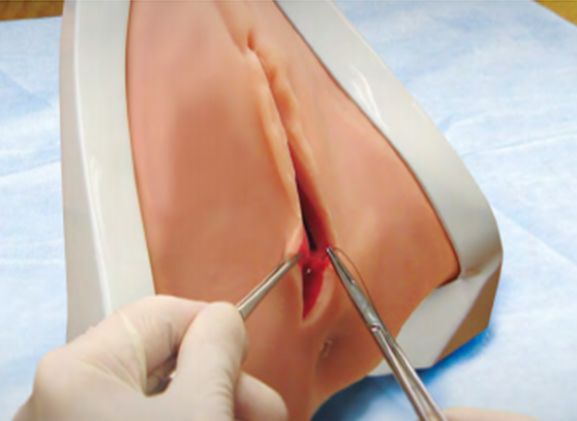 https://jayakelana.jayakelana.id/uploads/product/pelatih-perineal-perineal-prt-20--41963e3954c122f_cover.png