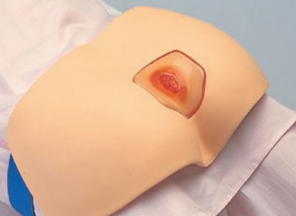 https://jayakelana.jayakelana.id/uploads/product/simulator-pengobatan-decubitus-m156--123164a81d274ef_cover.png