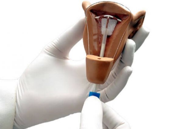 https://jayakelana.jayakelana.id/uploads/product/uterus-i-iud-placement-64463ffb81dc10c_cover.png